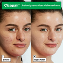 DR Jart+ - Cicapair - Redness Rescue Kit 30 ml+15 ml+15 ml+25 g