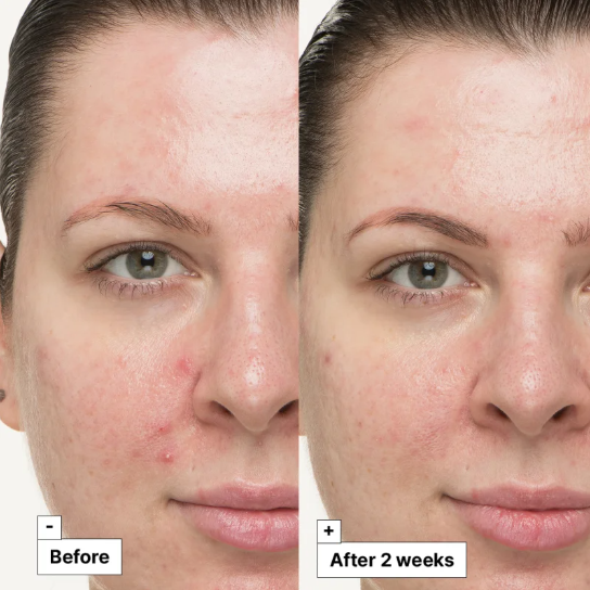 DR Jart+ - Cicapair - So soothing treatment 30 ml