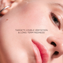 DARPHIN - Intral - Soothing and Fortifying Intensive Siero Viso Lenitivo, 30ml